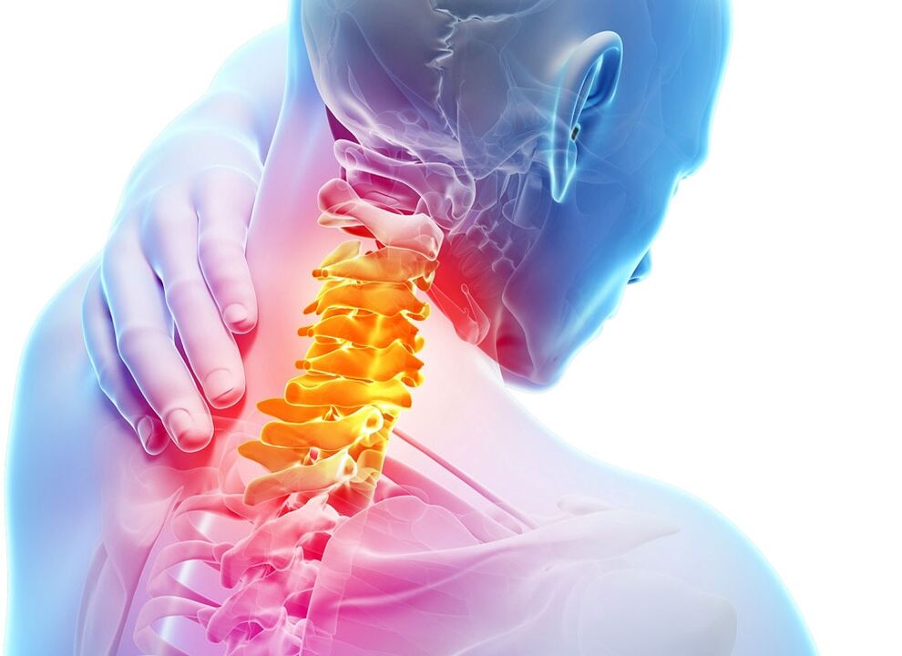 symptomen van cervicale osteochondrose